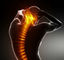Rumah Sakit Menggunakan Mesin Dekompresi Chiropractic Tingkat Penyembuhan Efektif Tinggi